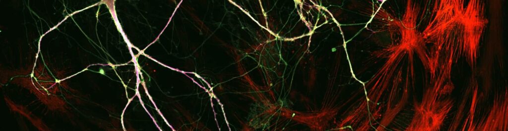 Confocal blog
