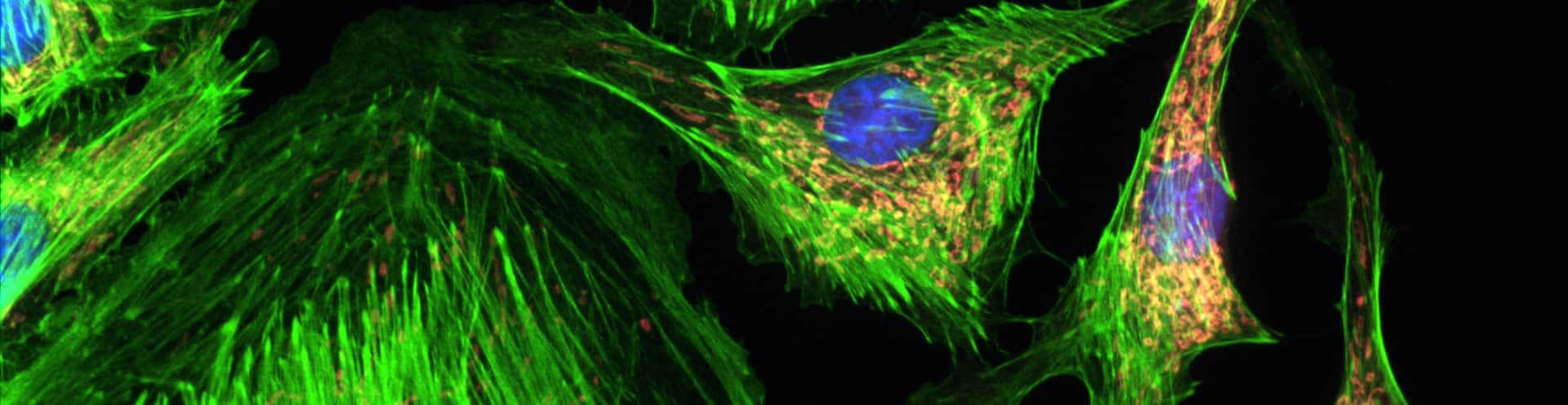 Advantages of Re-scan confocal microscopy