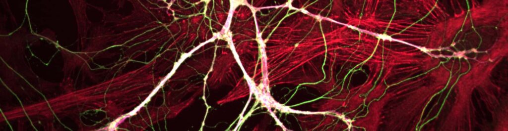 Confocal blog