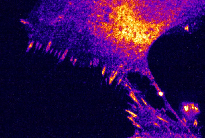 Fluorescence microscopy Nobel Prize