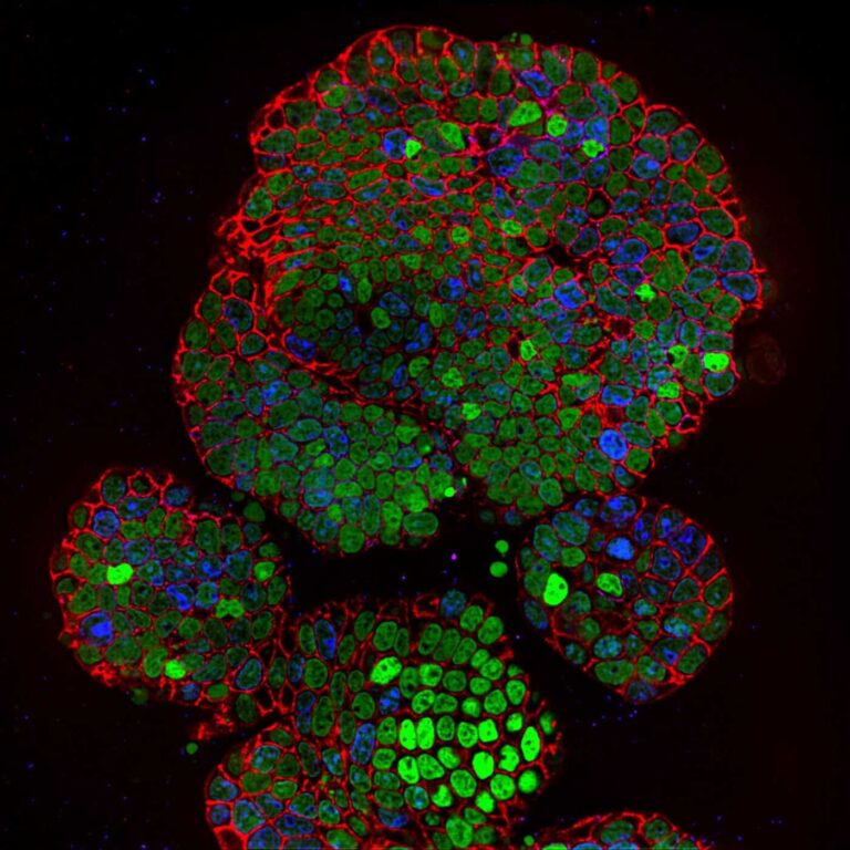 A fluorescence microscopy image of a lab-grown intestinal organoid, showing a spherical three-dimensional cluster of gut cells glowing against a dark background.