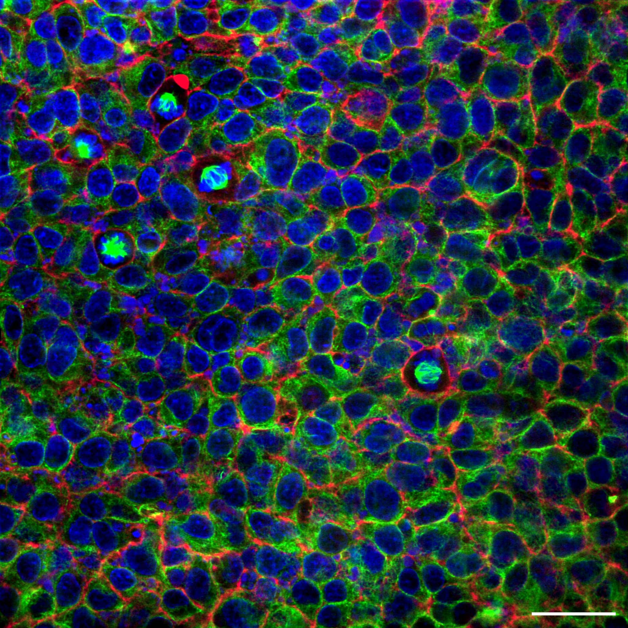 Part 7: Speed In REscan Confocal Miscroscopy