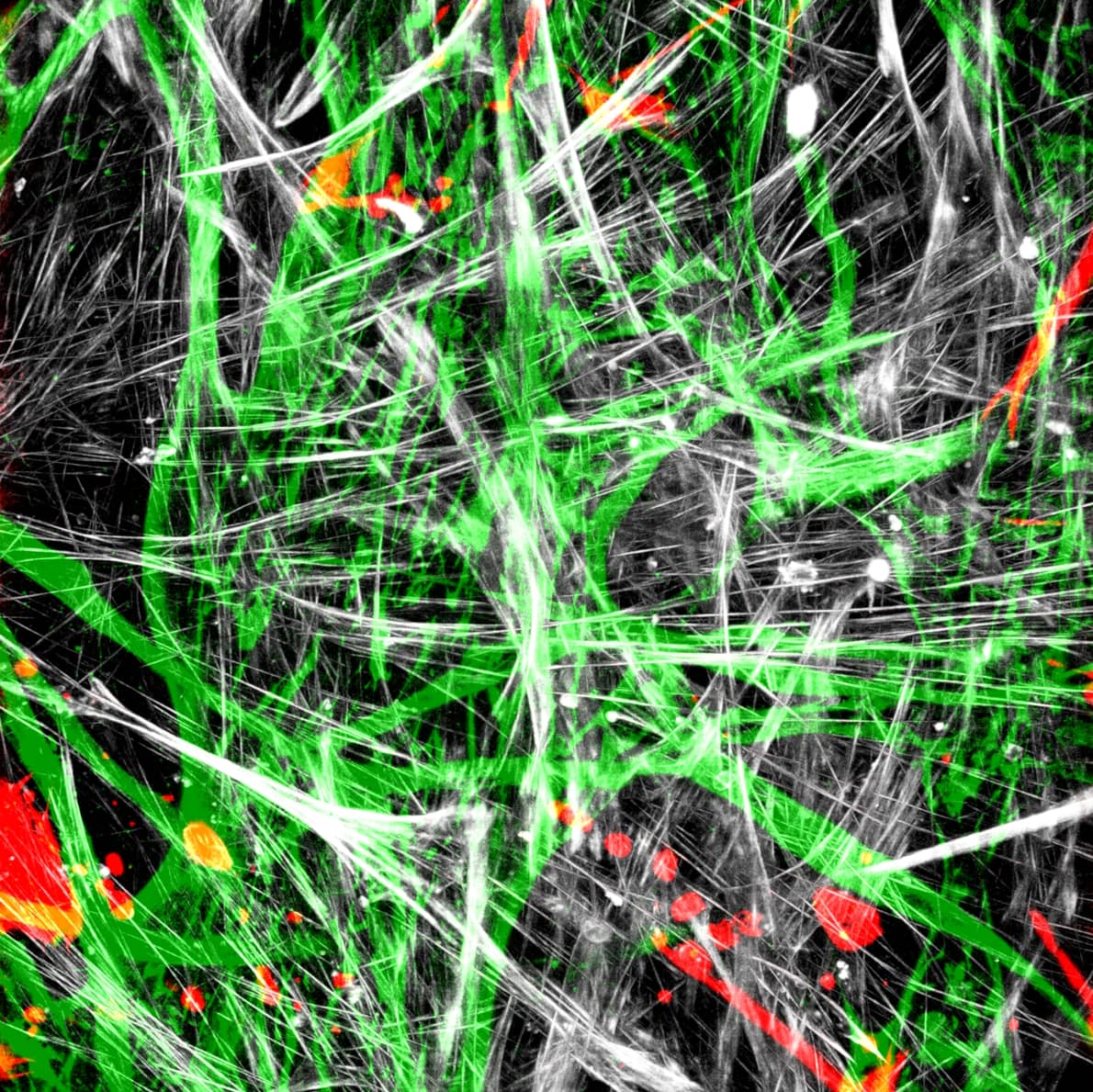 Part 8: Sensitivity in Line REscan confocal microscopy